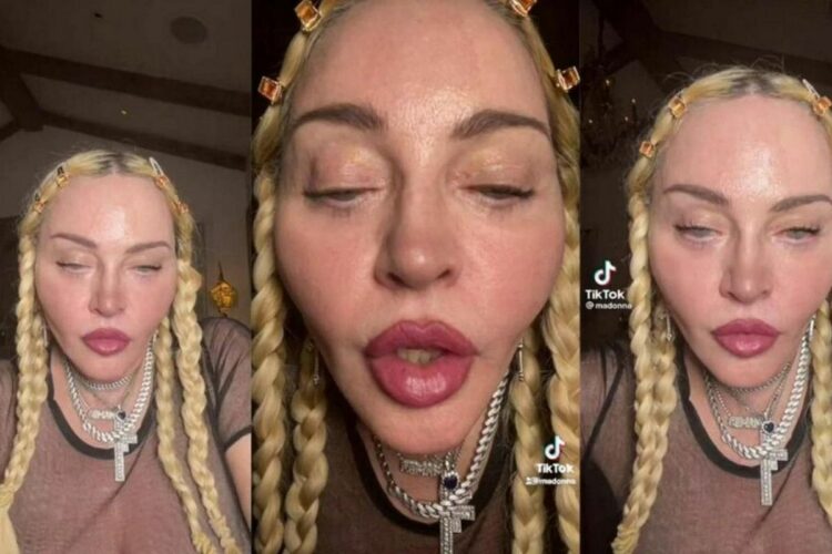 Madonna TikTok prima e dopo: malattia o rifatta? FOTO