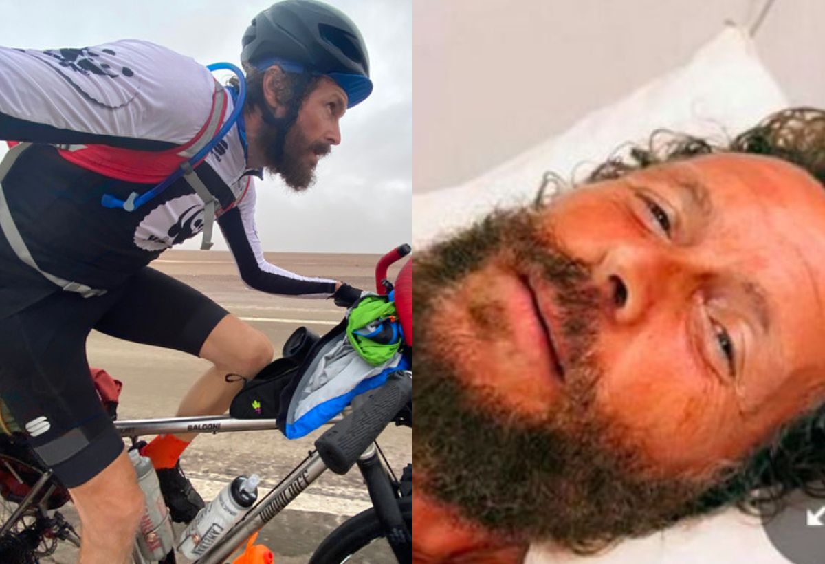 Jovanotti ricoverato incidente bici operato